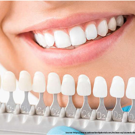 Cosmetic Dentistry  in rohini sector 15
